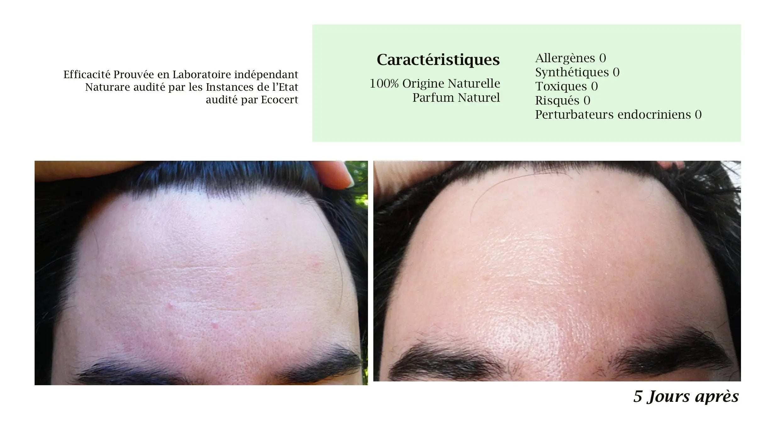 MERVEILLE DES LANDES ORGANIC - Sensitive Skin Care Complete Regeneration Face Naturare.fr
